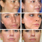 Whitening Freckles, Melasma, Dark Spot, Anti-aging Face Care